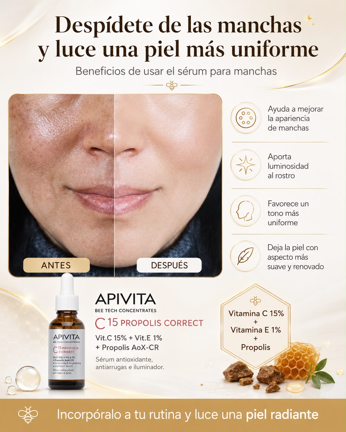 SERUM ANTI-MANCHAS™⭐⭐⭐⭐⭐ combate las manchas de tu piel
