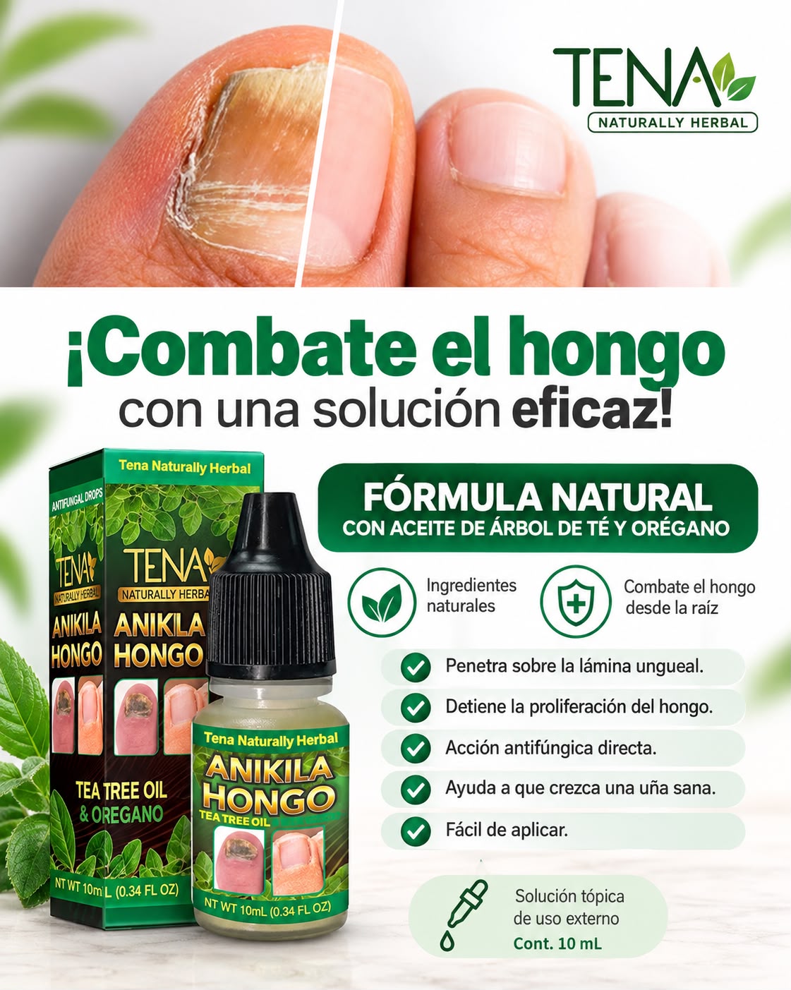 ANIKILA HONGOS⭐⭐⭐⭐⭐RESTAURA UÑAS AMARRILAS Y CON HONGOS