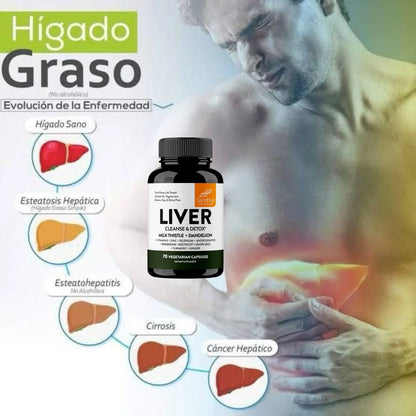 LIVER™ ⭐⭐⭐⭐⭐ Desintoxica tu higado graso