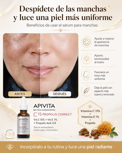 SERUM ANTI-MANCHAS™⭐⭐⭐⭐⭐ combate las manchas de tu piel