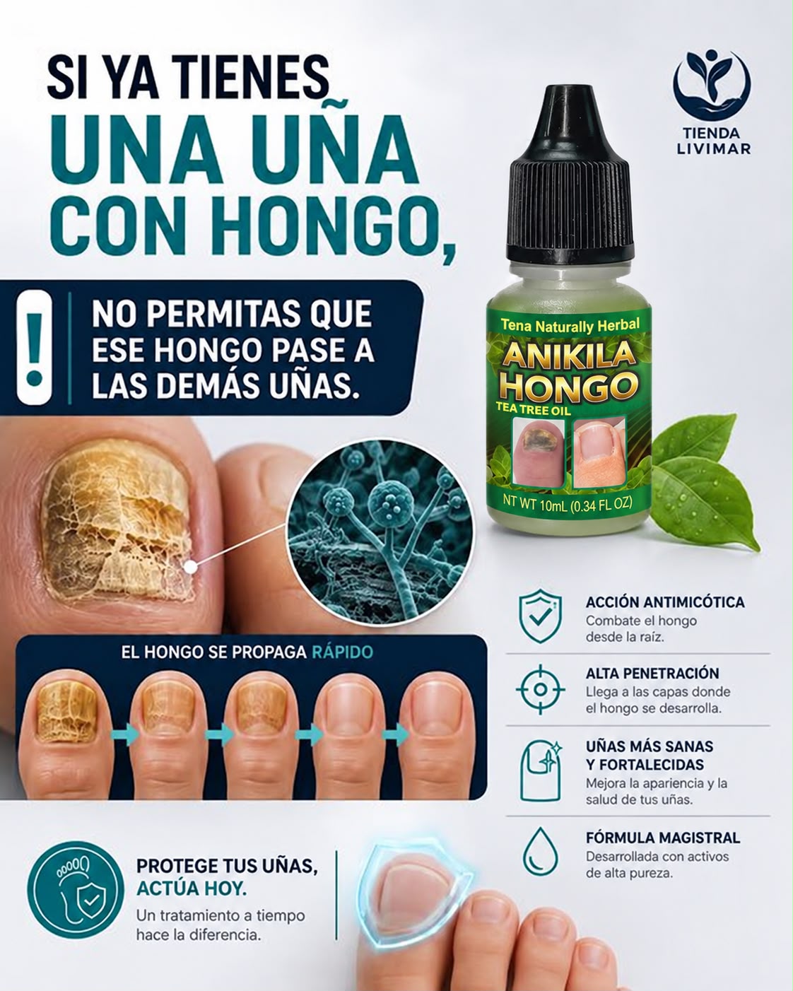 ANIKILA HONGOS⭐⭐⭐⭐⭐RESTAURA UÑAS AMARRILAS Y CON HONGOS
