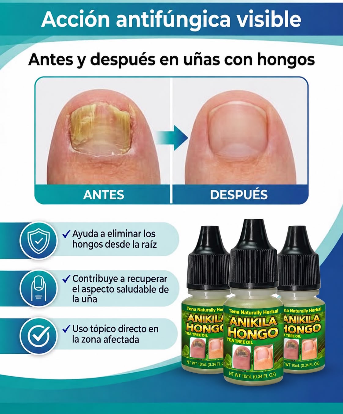 ANIKILA HONGOS⭐⭐⭐⭐⭐RESTAURA UÑAS AMARRILAS Y CON HONGOS