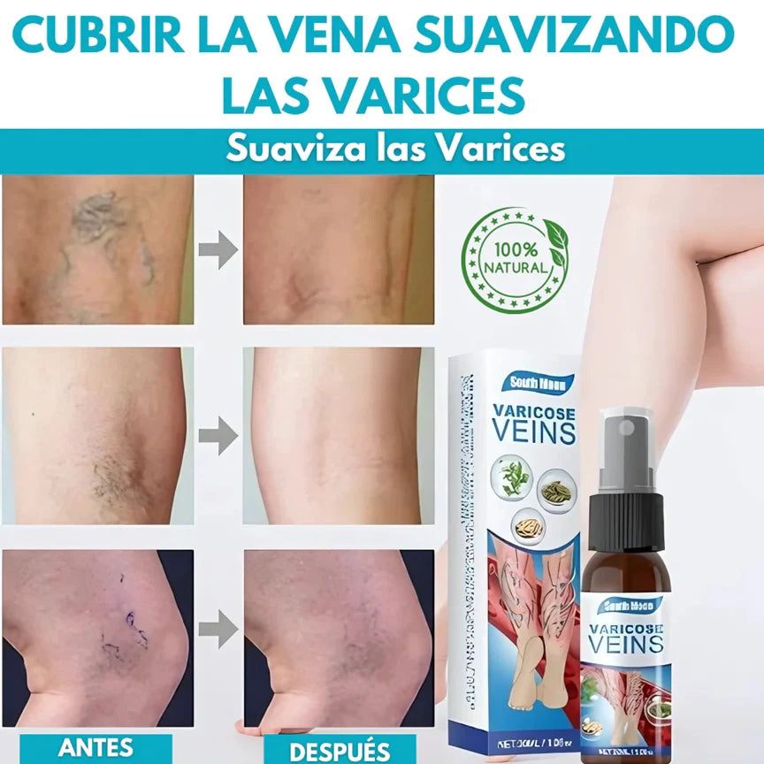 SPARY ANTI-VARICES™ ⭐⭐⭐⭐⭐ Elimina las arañitas de tus piernas